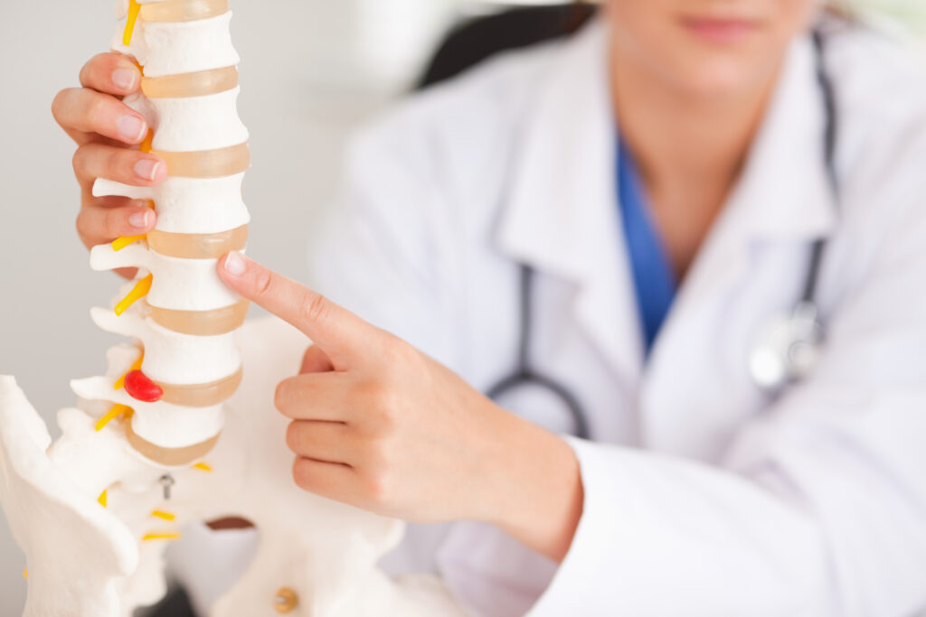 Understanding Spinal Cord Injuries in Florida